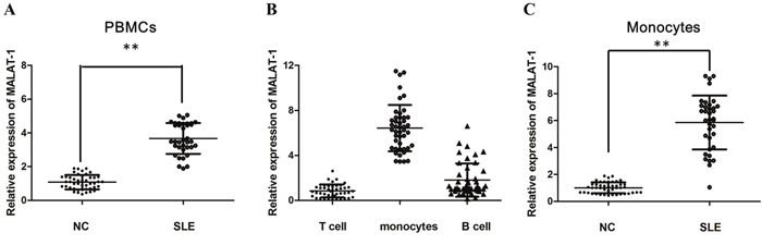 The relative expression of MALAT-1 was determined by qPCR in SLE patients.