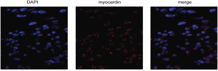 Myocardin is expressed in rat glomerular mesangial cells (MCs).