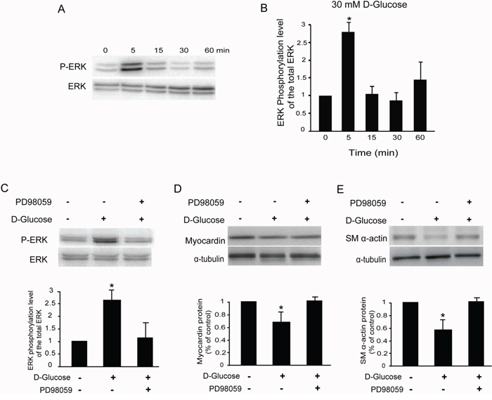 High glucose activates the ERK pathway in rat glomerular MCs.