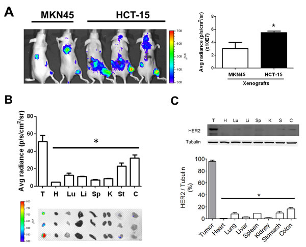 HER2 imaging in the tumors and organs of HCT-15-induced xenografts in mice.