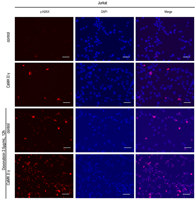 High expression of activated CaMKII&#x03B3; in T-ALL cells increases DNA damage.