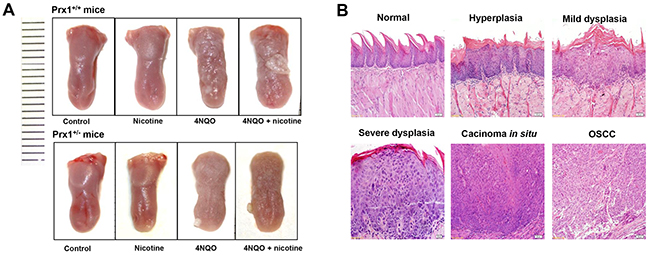 Histopathology of mouse tongue in animals treated with nicotine, 4NQO or ANQO plus nicotine.