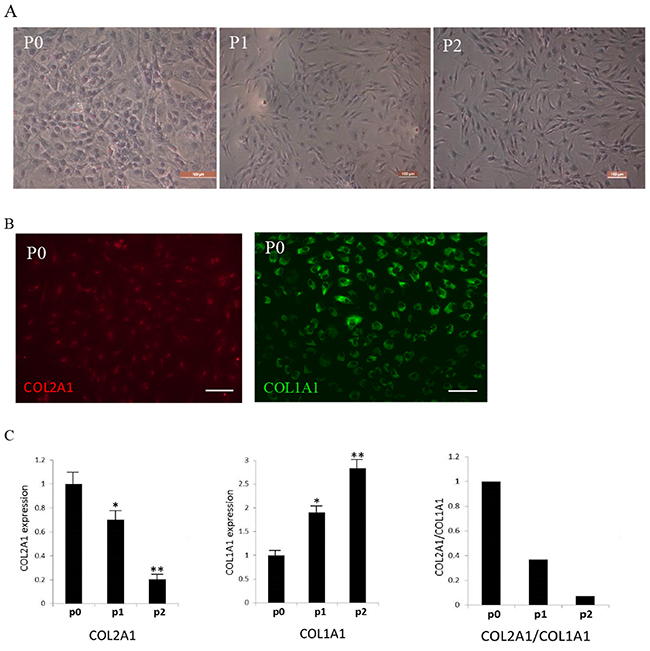 Identification of isolated human articular chondrocytes.