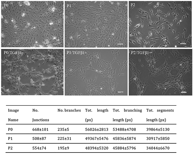 Representative images of P0 to P2 chondrocytes treated with 10ng/ml TGF&#x03B2;1 and quantitative analysis of network formation.