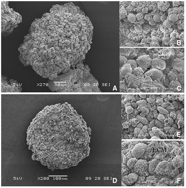 3D topology of SUM1315 and MDA-MB-231 spheroids by Scanning Electron Microscopy (SEM).