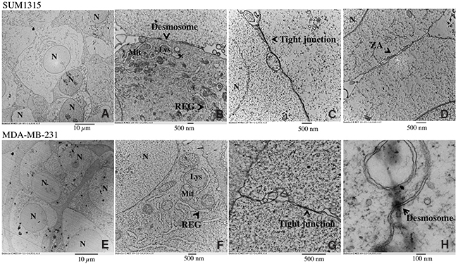 Ultrastructure of SUM1315 and MDA-MB-231 spheroids by Transmission Electron Microscopy (TEM).