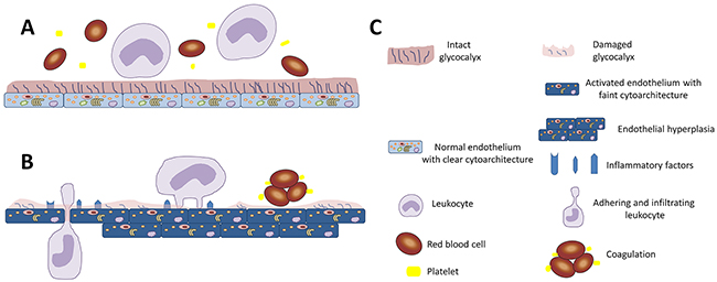 Diagrammatic representation of the importance of glycocalyx in endothelial function.