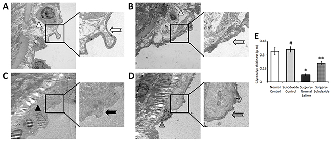 Sulodexide reconstructs the endothelial glycocalyx shown by electron microscopy.