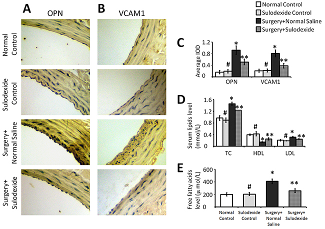 Sulodexide inhibits the atherosclerosis-related factors OPN and VCAM1, and regulates lipid metabolism.