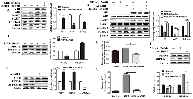 SIRT1 knockdown impairs and SIRT1 overexpression improves glucose and lipid metabolism in hepatocytes.