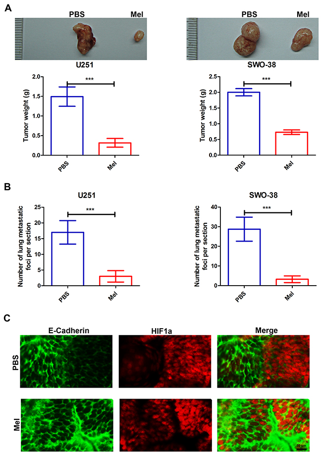 Effect of melatonin on metastasis capacities of glioma cells in vivo.