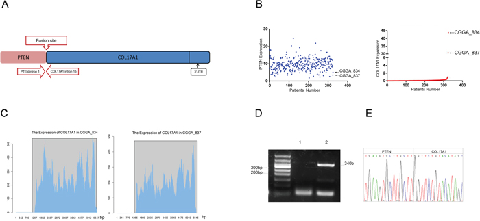 Identification and characterization of a novel PTEN-COL17A1 fusion in gliomas using RNA sequencing.