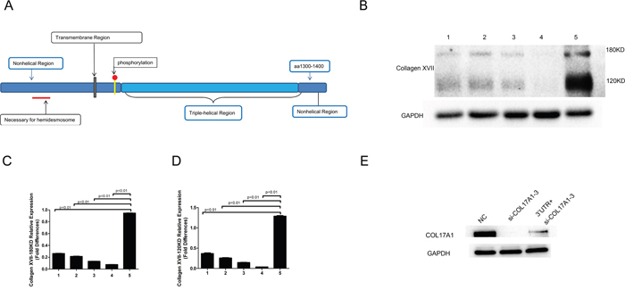 Increased level of Collagen XVII expression was observed in the PTEN-COL17A1 gene fusion positive samples.