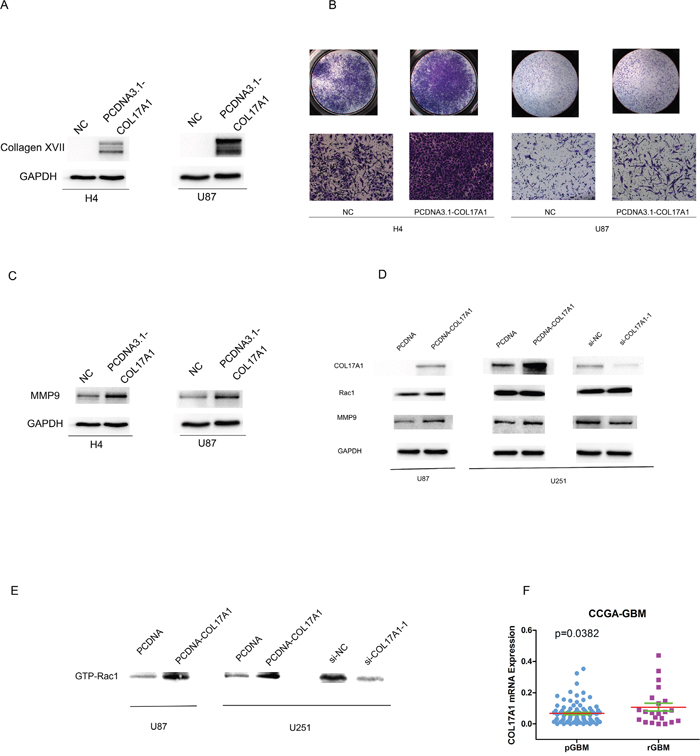 Increased Collagen XVII expression promotes invasive activities of glioma cells and associated with GBM recurrences.