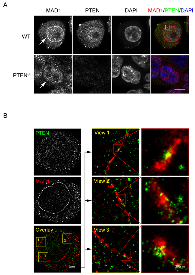 PTEN co-localizes with MAD1 at the nuclear envelope.