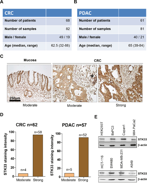 STK33 is expressed in human colorectal (CRC) and pancreatic (PDAC) tumor specimens.