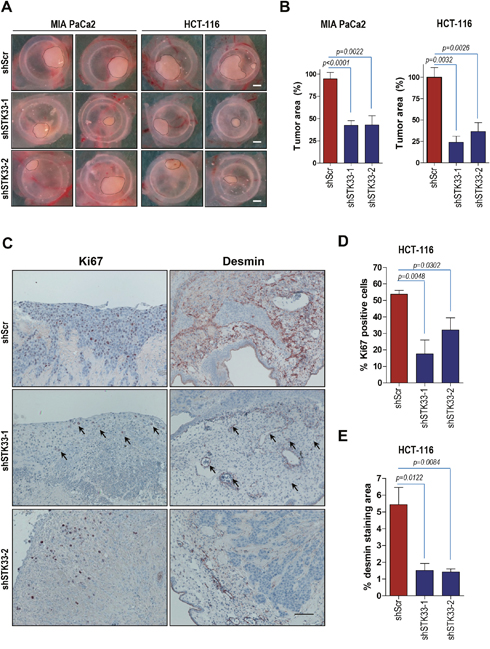 Deletion of STK33 results in decreased tumor growth and impaired tumor-driven vascularization in vivo.