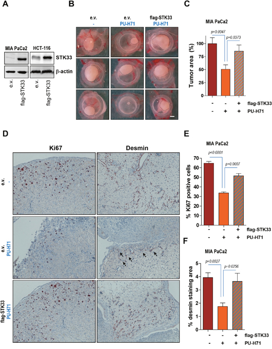 Ectopic STK33 restores the in vivo tumor growth and tumor-driven vascularization after HSP90 inhibition.