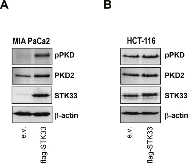 STK33 cooperates with other protein kinase clients stabilized by HSP90 during tumor progression.