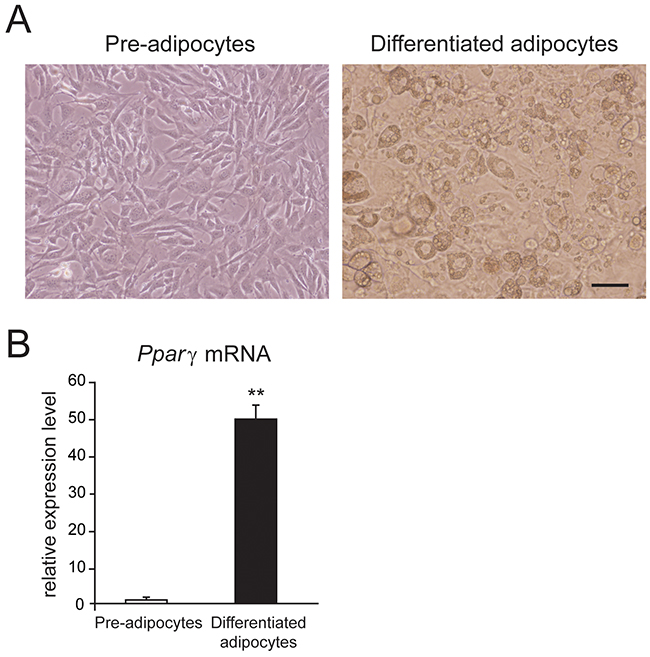 Mouse white adipocytes in culture.