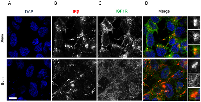 Immunofluorescence assay to detect relative expression of IR&#x03B2; and IGF1R protein in anterior tibial muscle obtained from burn and sham rats at day 7.