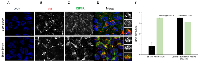 Immunofluorescence assay to detect relative expression of IR&#x03B2; and IGF1R protein in L6 cells treated for 24 hours with serum obtained from sham rats and burn rats at day 7.