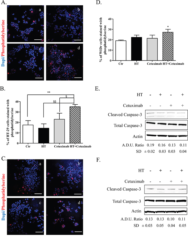 HT and cetuximab combination induces caspace3-independent apoptosis in colorectal cancer cells.