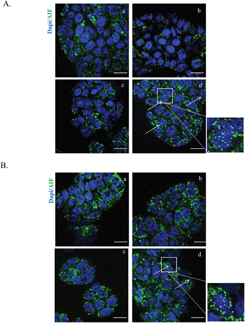 HT and cetuximab combination stimulates AIF release from the mitochondria to the cytoplasm and nuclear translocation evaluated by immunofluorescence.