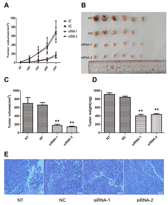 Effect of AFAP1-AS1 knockdown on tumor growth in vivo.