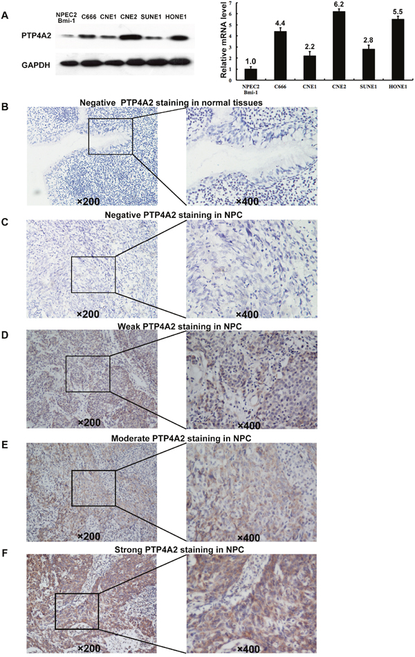 Western blotting, qPCR and IHC assay of the expression of PTP4A2 in NPC cell lines and tissues.