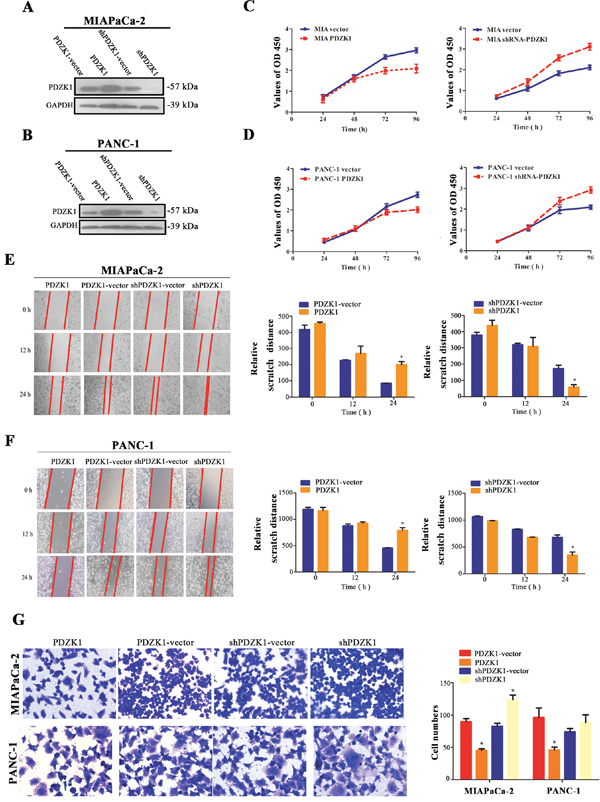Effects of stable PDZK1 knockdown and overexpression on proliferation and migration abilities of pancreatic cancer cells in vitro.