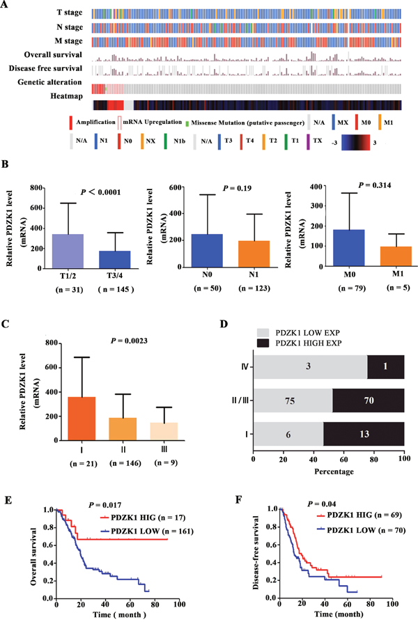 The PDZK1 expression level correlates with progression/prognosis of patients with PDAC.