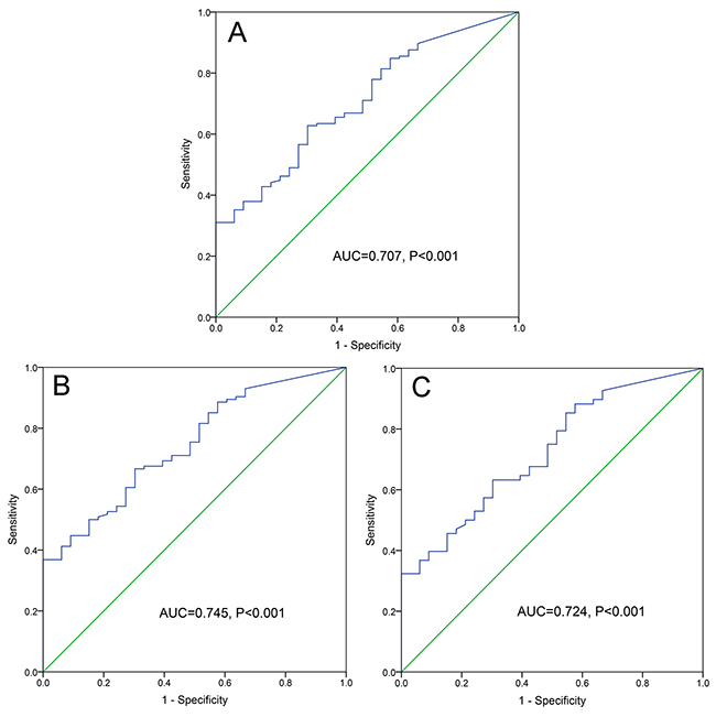 ROC curve analysis of ID2 expression for discriminating AML patients form controls.