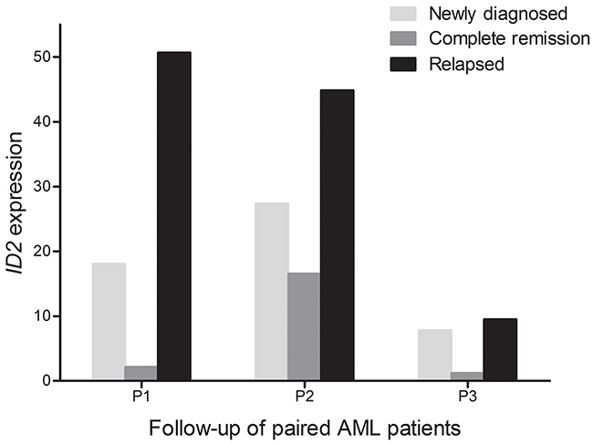 Dynamic change of ID2 expression in the three paired AML patients of different stages (newly diagnosis, complete remission, and relapse time).
