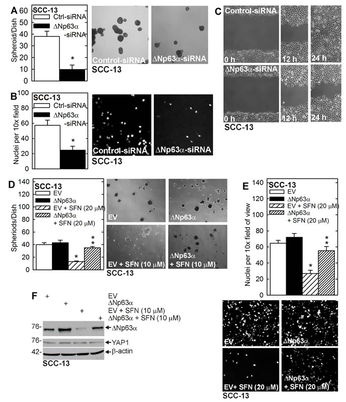 &#x2206;Np63&#x3b1; drives the ECS cell phenotype.