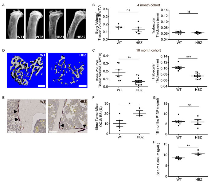 Gzmb-HBZ mice develop bone loss and hypercalcemia.