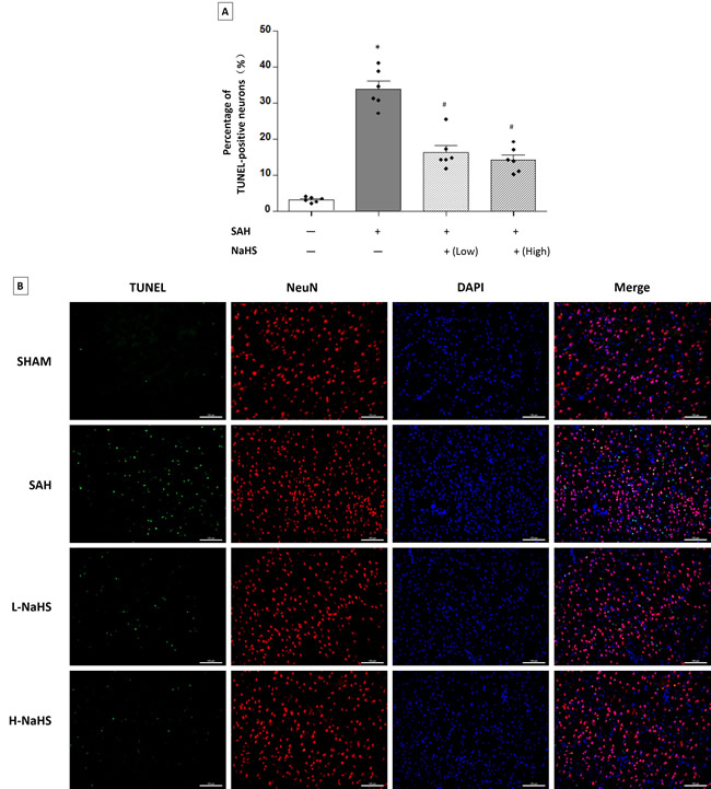 Both low and high dosages of exogenous NaHS decreased neuronal cell apoptosis.