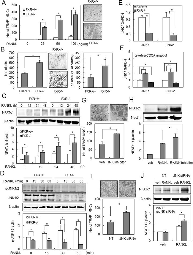 FXR deficiency increases osteoclast differentiation via downregulation of JNK1/2 expression.