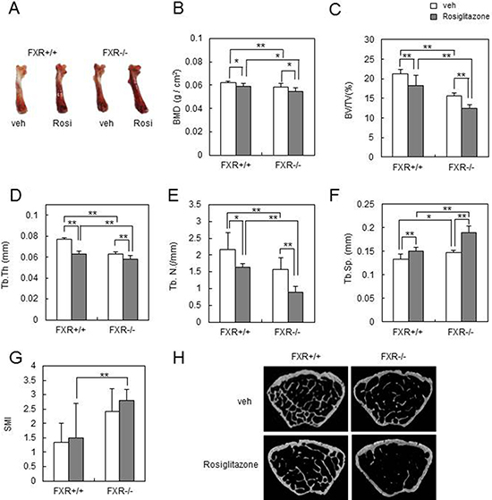 FXR deficiency increases rosiglitazone-induced bone loss in vivo.