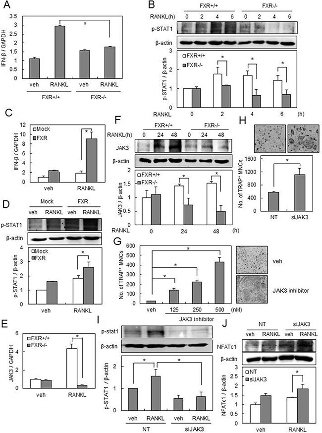 FXR deficiency down-regulates IFN-&#x03B2; signaling pathways via JAK3-STAT1.