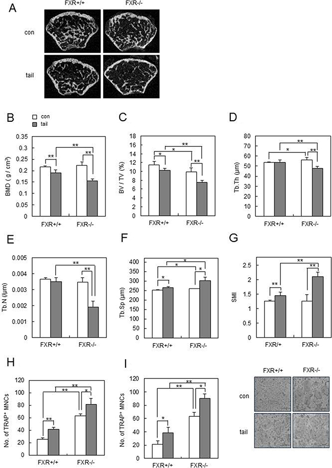 FXR deficiency accelerates unloading-induced bone loss in vivo.