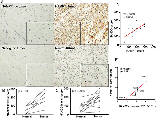 NAMPT expression correlated with high levels of cancer stem cell-like cells in glioblastoma extracted directly from patients.