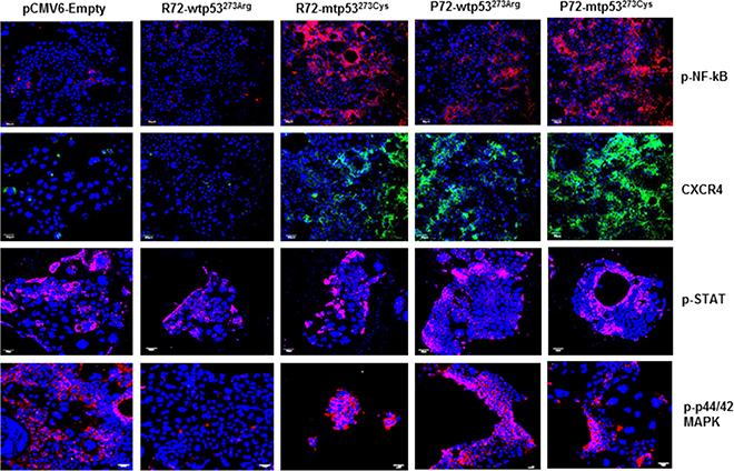 P72 phenotype of p53 is associated with abundance of tumor promoting phenotypes.