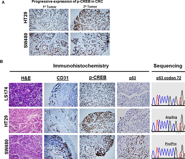 CREB expression in tumor xenografts by IHC.