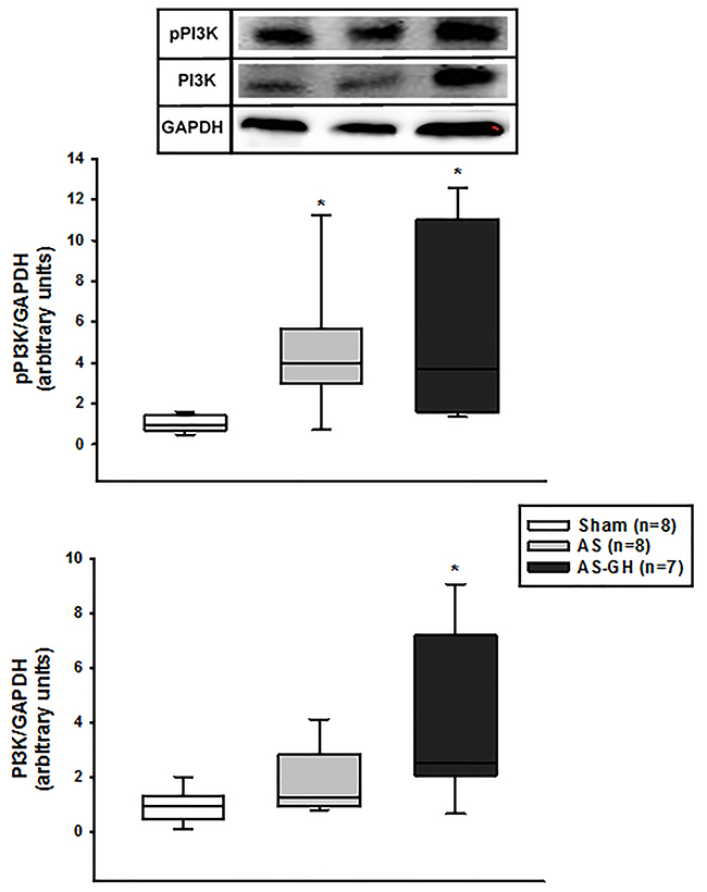 Phosphorylated phosphatidylinositol-3-kinase (PI3K) and total PI3K protein expression in soleus muscle assessed by Western blot.