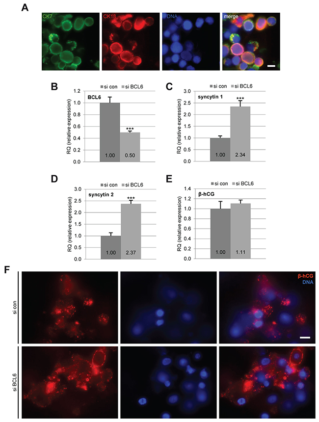 Reduction of BCL6 increases the expression of fusion-related genes in primary cytotrophoblasts.
