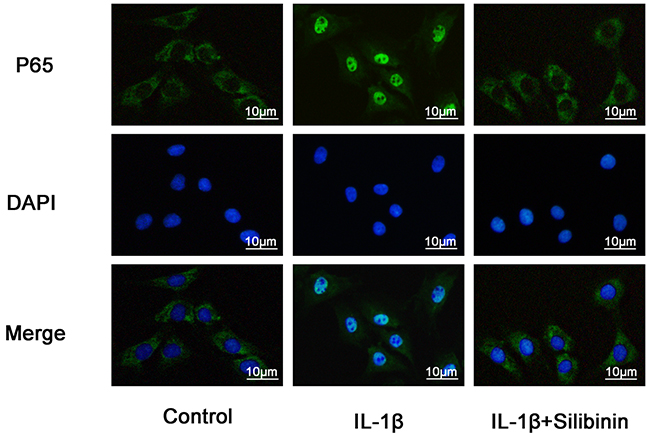 Effect of silibinin on IL-1&#x03B2;-induced nuclear translocation of NF-&#x03BA;B p65 in human OA Chondrocytes.