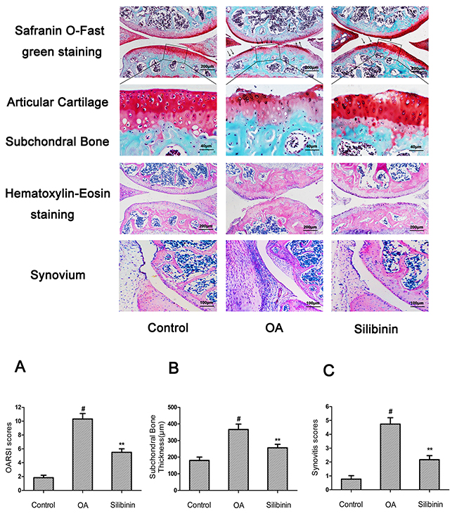 Silibinin attenuated the cartilage destruction, subchondral bone thickness and synovitis in mice OA models.