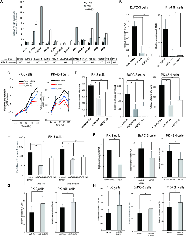 EVI1 modulates the oncogenic role of GPC1 in pancreatic cancer.