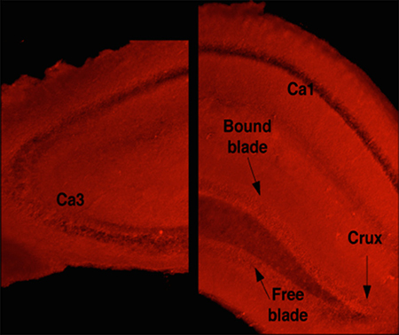 Representative image of a hippocampal slice incubated with DHE.